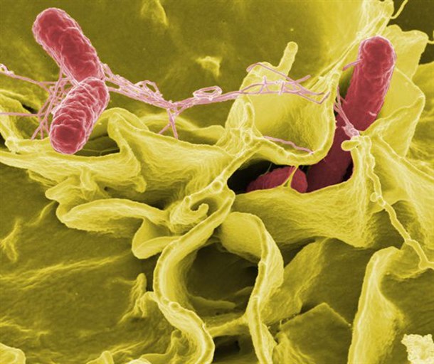 Bacteria of salmonella, photo from “Wikipedia”. 